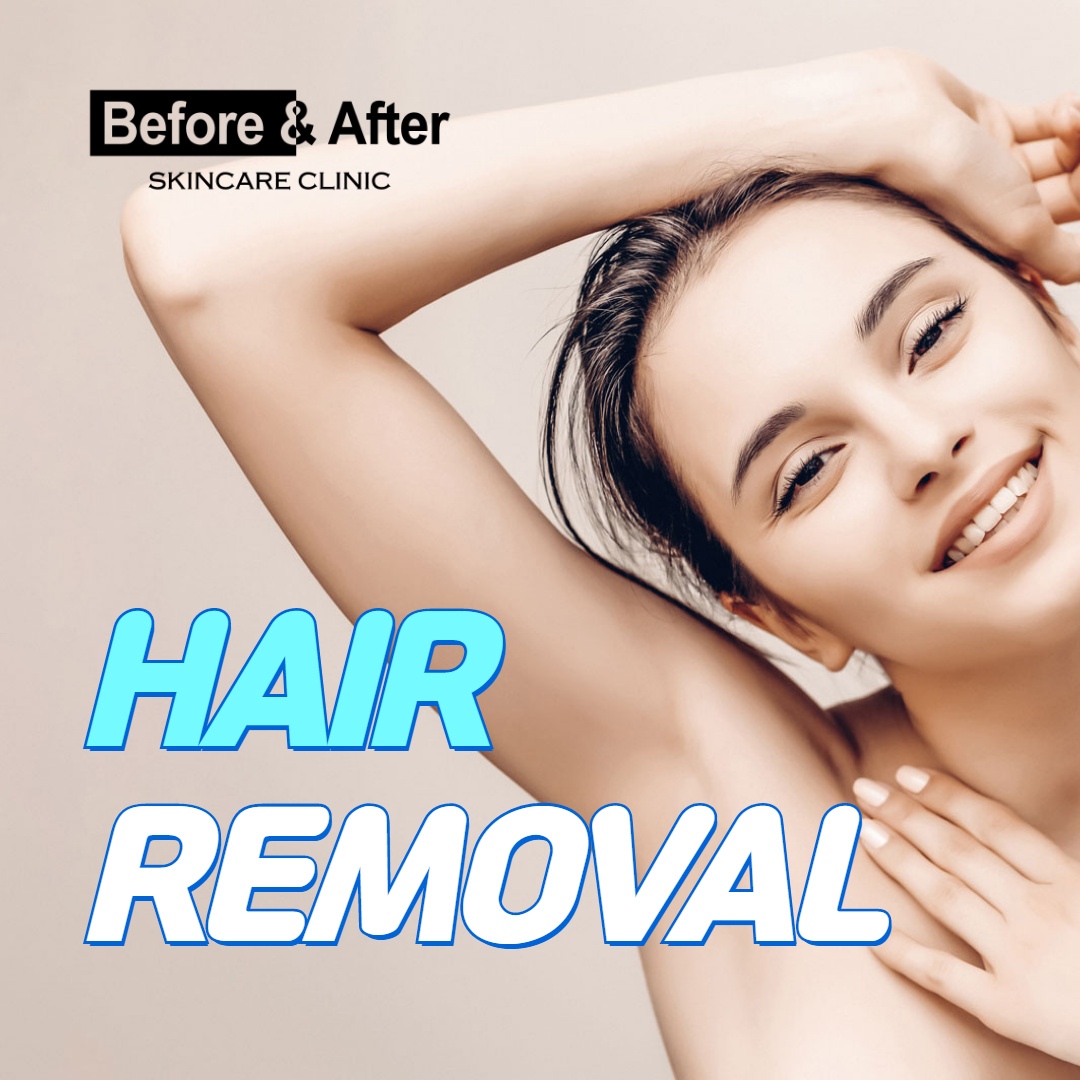 before and after hair removal